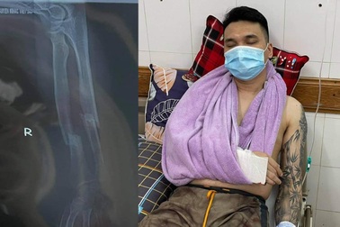 Ca sĩ Khắc Việt bị gãy xương cổ tay, hủy toàn bộ lịch diễn