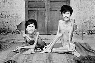 Báo Đức đòi công lý cho nạn nhân da cam Việt Nam