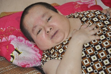 Rớt nước mắt cảnh “người cá” vượt trăm cây số nương nhờ em gái bát cháo qua ngày