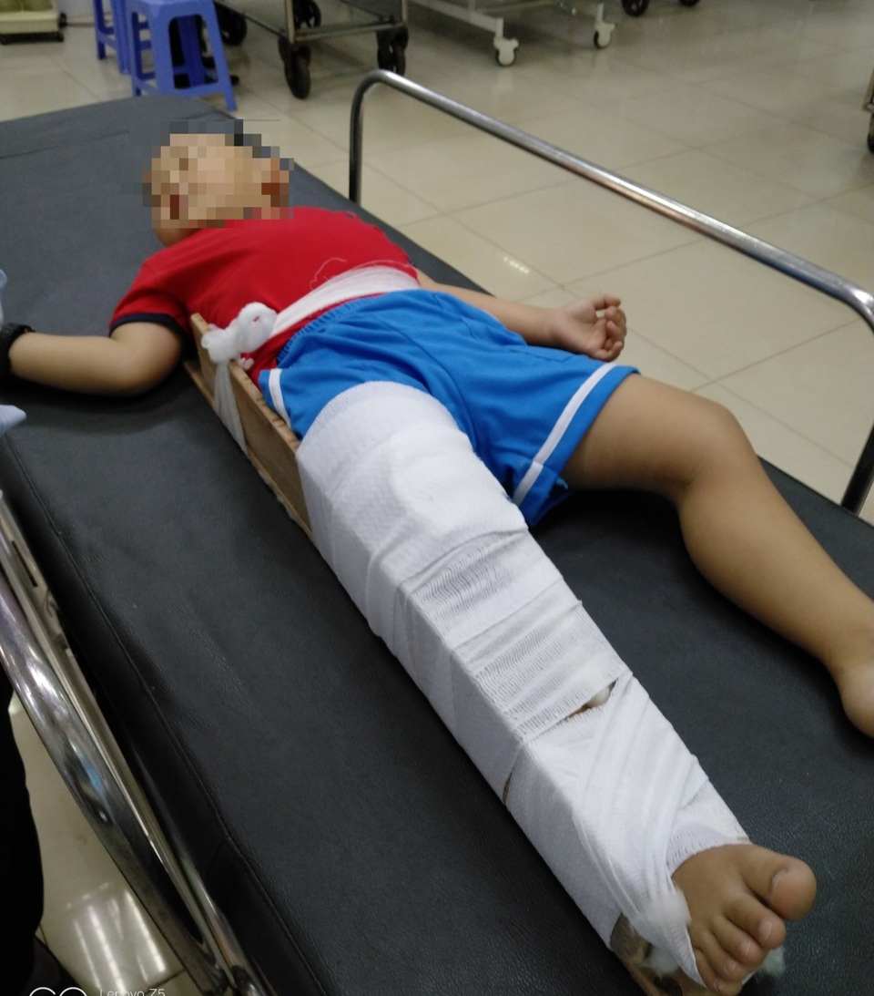 Vụ bé 4 tuổi gãy chân tại trường: Cô giáo quỳ khóc xin lỗi - 2 Vụ bé 4 tuổi gãy chân tại trường: Cô giáo quỳ khóc xin lỗi - 2