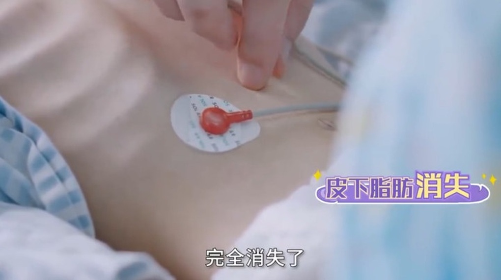 Chạy theo mốt gầy là đẹp, nhiều cô gái giảm cân quá đà bất chấp hậu quả - 1 Chạy theo mốt gầy là đẹp, nhiều cô gái giảm cân quá đà bất chấp hậu quả - 1