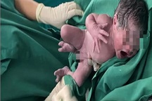 Ung thư vòm họng thai kỳ thách thức lớn trong điều trị