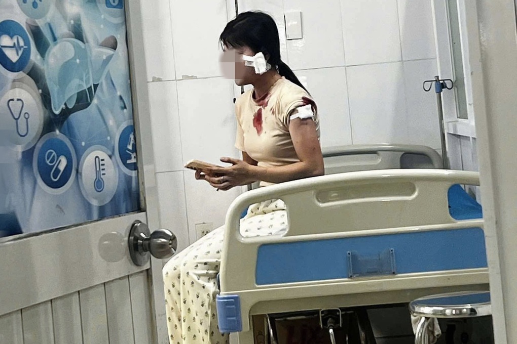 Người phụ nữ bị chồng cũ túm tóc, đấm liên tiếp vào mặt ở Bình Dương - 2 Người phụ nữ bị chồng cũ túm tóc, đấm liên tiếp vào mặt ở Bình Dương - 2