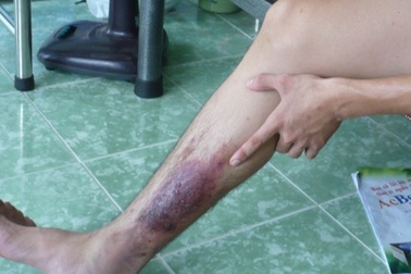 “Bệnh lạ” ở ĐH Cần Thơ: “Thủ phạm” là kiến ba khoang