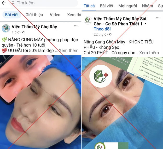 Sau khi bị hàng loạt cơ sở thẩm mỹ lấy tên là Thẩm mỹ Chợ Rẫy, Viện thẩm mỹ Chợ Rẫy…, bệnh viện còn bị giả mạo cả trang fanpage. 
