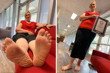 Nỗi khổ của người phụ nữ lập Kỷ lục Guinness Thế giới với bàn chân "khủng"