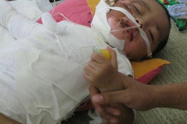 Bé Đạt đã vượt qua giai đoạn nguy hiểm 