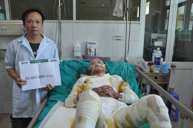 Hơn 60 triệu đồng đến với cậu bé Ân bỏng nặng