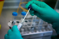 Hà Nội: Giá dịch vụ xét nghiệm RT-PCR tối đa gần 170 nghìn đồng
