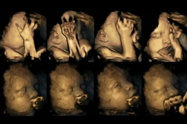 12 bức ảnh ấn tượng nhất của y học thế giới năm 2015