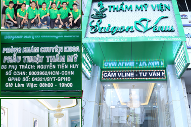 Nổ “inbox” vì trùng tên Venus