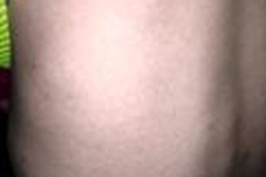 Thanh Hóa: Nhiều trẻ em mắc bệnh sởi phải nhập viện