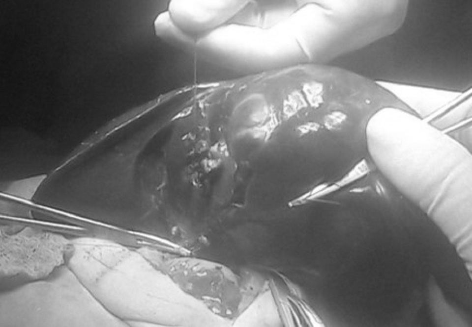 Vàng da sơ sinh ở trẻ, coi chừng bệnh lý nguy hiểm - 2 Vàng da sơ sinh ở trẻ, coi chừng bệnh lý nguy hiểm - 2