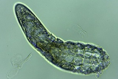 Phát hiện loài bọ ve siêu nhỏ trên mặt và đầu con người