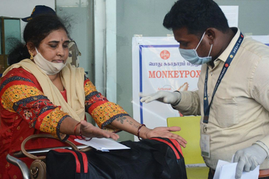 Ấn Độ ghi nhận trường hợp đầu tiên nghi tử vong do đậu mùa khỉ