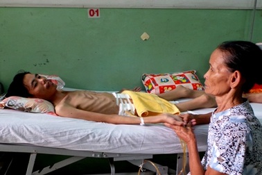 Mẹ nghèo khóc lặng trước cơ thể da bọc xương của con