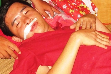 Đề nghị đình chỉ Phó trưởng công an xã bắn dân nhập viện