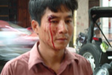 Nhân viên xe buýt đánh người: Hành động côn đồ hay tự vệ?