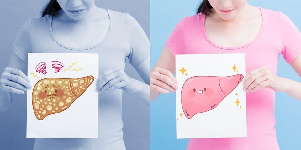 Người bệnh gan nhiễm mỡ ăn gì và kiêng gì? - 1 Người bệnh gan nhiễm mỡ ăn gì và kiêng gì? - 1