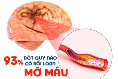 Nguy cơ đột quỵ do mỡ máu tăng cao sau Tết