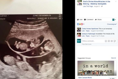 Hy hữu ca mang thai 6 sau khi tự uống thuốc hỗ trợ sinh sản