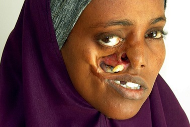 Chờ đợi 23 năm để có gương mặt mới