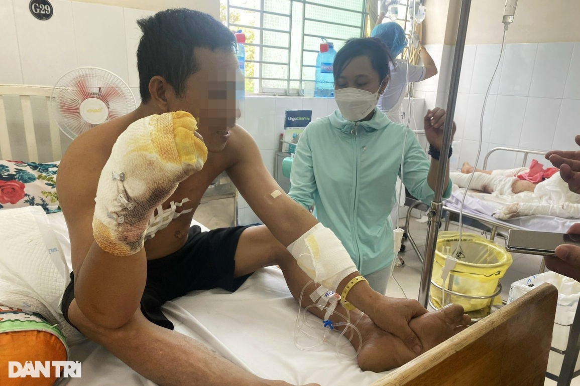 Gia tăng bỏng điện: Nhiều người bị cắt cụt tay, chân - 4 Gia tăng bỏng điện: Nhiều người bị cắt cụt tay, chân - 4