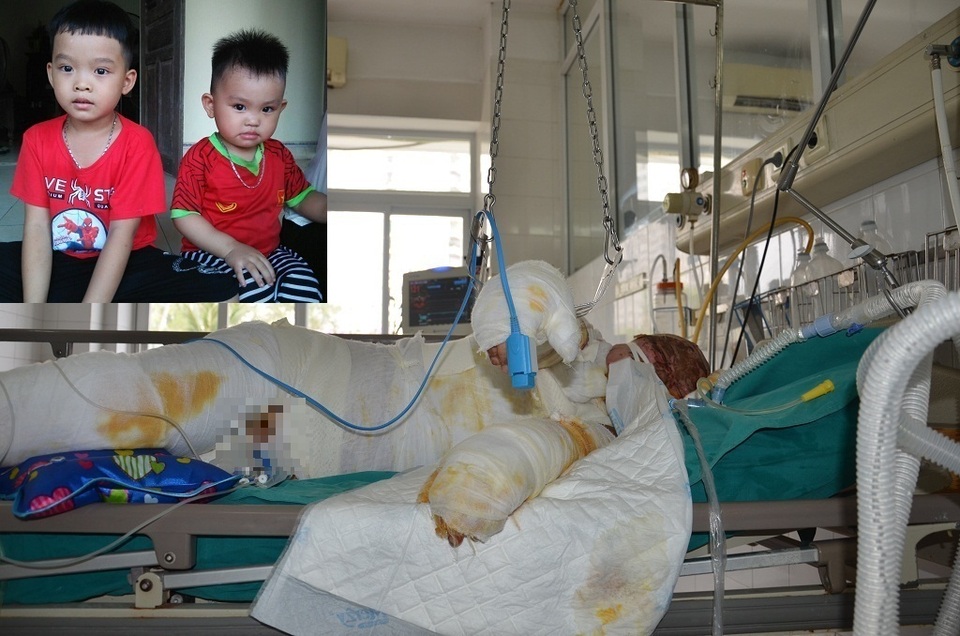 Xót xa người vợ trẻ đi hái mít bị điện cao thế giật nguy kịch đến tính mạng - 4 Xót xa người vợ trẻ đi hái mít bị điện cao thế giật nguy kịch đến tính mạng - 4