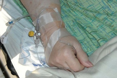 Bệnh nhân bị "điều trị oan" ung thư hiếm gặp suốt 5 năm mới phát hiện bác sĩ... nhầm