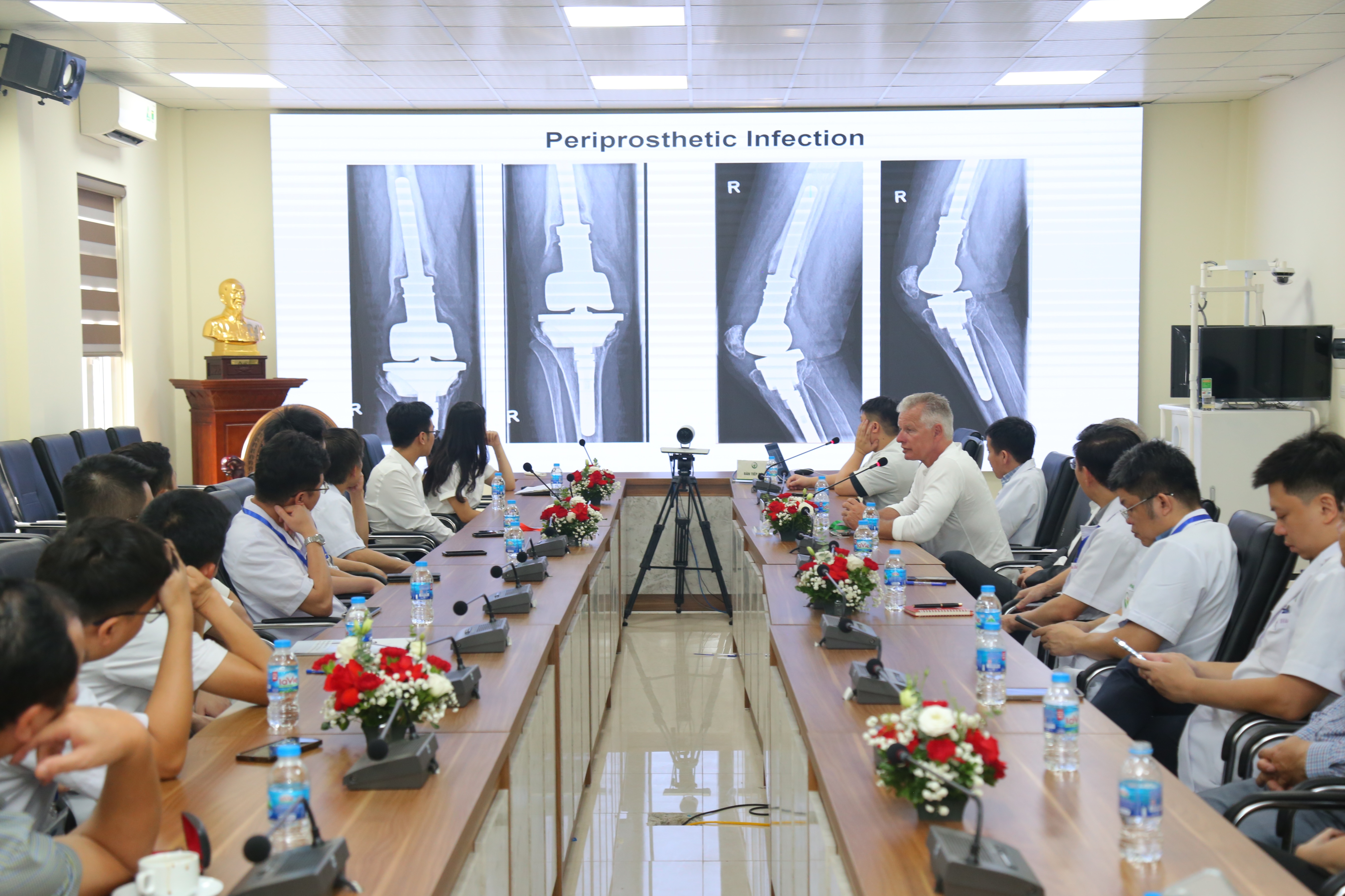 Bệnh nhân tàn phế đi lại được nhờ thay khớp gối, ám ảnh nhiễm trùng - 2
