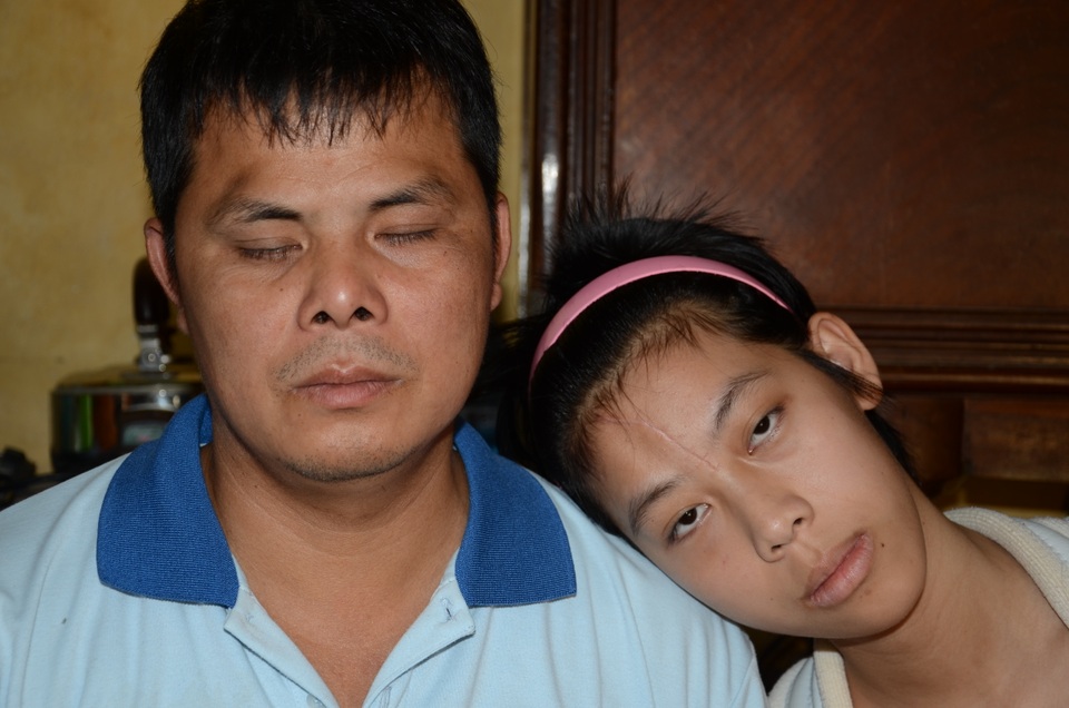 Người cha mù hát rong bật khóc khi con gái được phẫu thuật nhờ sự giúp đỡ của bạn đọc - 2 Người cha mù hát rong bật khóc khi con gái được phẫu thuật nhờ sự giúp đỡ của bạn đọc - 2