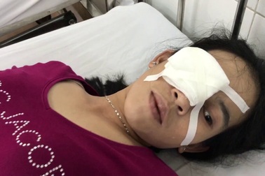 2 người phụ nữ bị cướp đạp ngã trên xa lộ Hà Nội