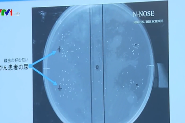 Bộ xét nghiệm phát hiện ung thư bằng giun tròn