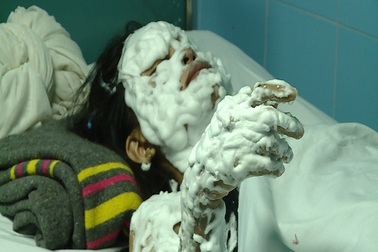 Nổ bóng bay trong đêm trung thu, 6 người nhập viện