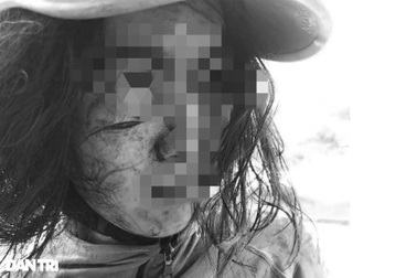 Khởi tố người chồng dùng mảnh thủy tinh rạch nát mặt vợ