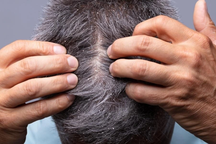 Tên cướp táo tợn sa lưới vì những mảnh gầu trong chiếc tất trùm đầu