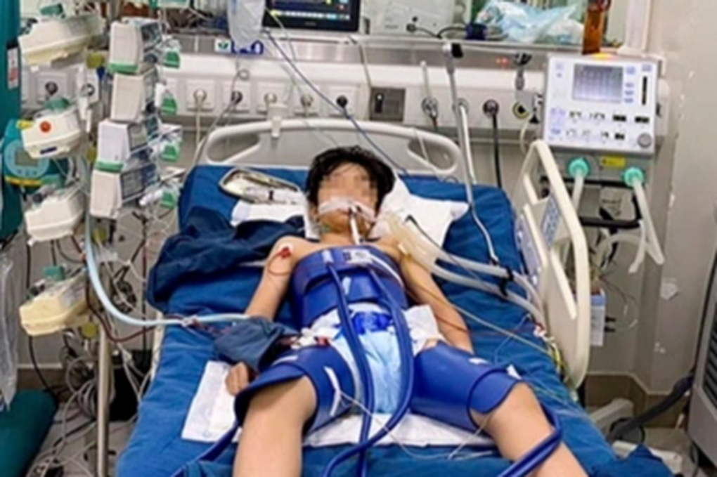 Sau pha bắt bóng, bé trai đột ngột ngừng tim gần 60 phút - 1 Sau pha bắt bóng, bé trai đột ngột ngừng tim gần 60 phút - 1