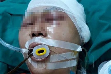 Hà Nội: Nam học sinh bị đánh chấn thương sọ não ở gần nhà