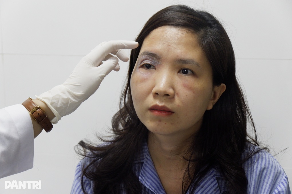 Hà Nội: Kiến ba khoang vào mùa, nhiều người nhập viện vì sưng mắt, loét da - 3 Hà Nội: Kiến ba khoang vào mùa, nhiều người nhập viện vì sưng mắt, loét da - 3