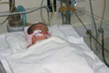 Sinh mổ sớm, chưa phúc đã... họa!