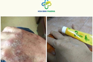 Công thức đột phá của kem bôi da Thuần Mộc