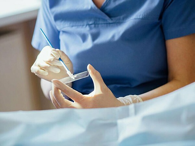 Những điều ít biết về ung thư cổ tử cung - Ảnh 1. Những điều ít biết về ung thư cổ tử cung - Ảnh 1.