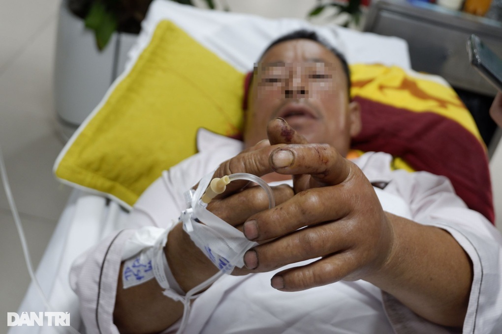 Sau nhát cắn của con không chân, nhiều người hoại tử vì trúng độc - 2 Sau nhát cắn của con không chân, nhiều người hoại tử vì trúng độc - 2