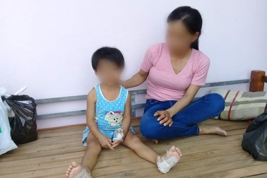 Nghi án bé gái bị cha dượng đánh đập, dí người vào ống pô nóng