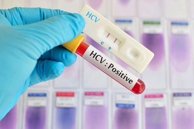 Những xét nghiệm máu cần làm sau tuổi 50