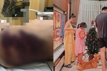 "Mẹ kế" bạo hành bé gái 8 tuổi tử vong: Con trở thành bao cát để trút giận?