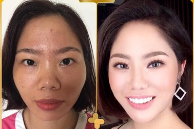 Điểm mặt những gương mặt gây bão mạng sau khi phẫu thuật