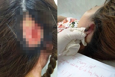 Những tai nạn không ngờ khi làm tóc