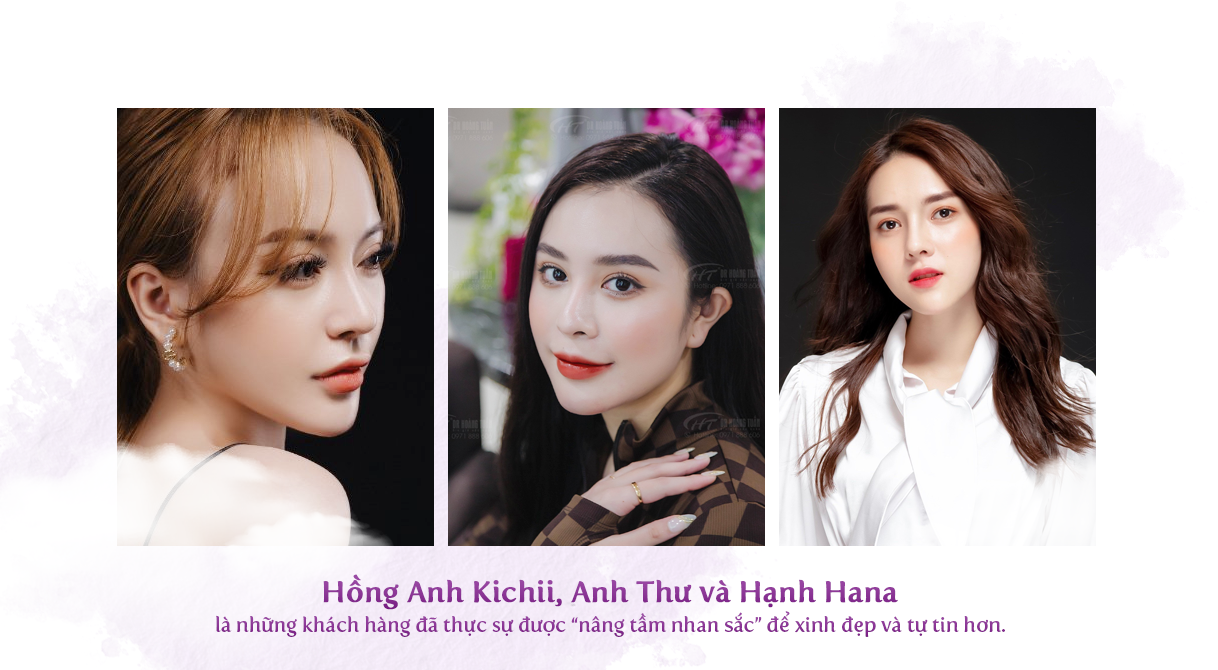 Hành trình 10 năm xây dựng và khẳng định thương hiệu Thẩm mỹ Hoàng Tuấn - 11 Hành trình 10 năm xây dựng và khẳng định thương hiệu Thẩm mỹ Hoàng Tuấn - 11