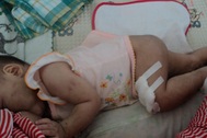 Cháu bé 9 tháng tuổi bị hành hạ dã man